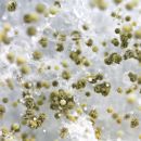 A microscopic closeup of mold spores